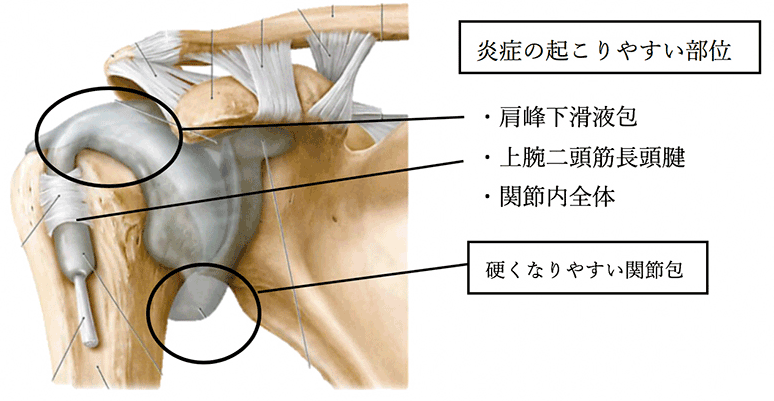 肩関節周囲炎とは 横浜 みなとみらいの整形外科ならプライムコーストみなとみらいクリニック